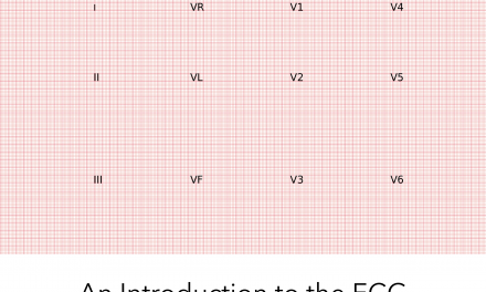 Introduction to the ECG