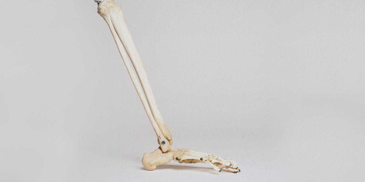 Bone Abnormalities